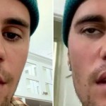 Justin Bieber menderita penyakit Ramsay Hunt-1654949595